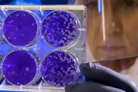 Wabah Virus Nipah di India Merebak, Tenaga Medis Terinfeksi dan Puluhan Warga Dikarantina Ilustrasi penelitian medis (foto: CDC, unsplash)